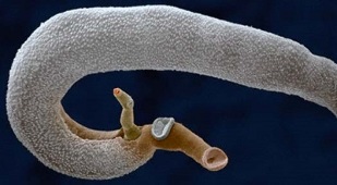 insan midesinde hangi parazitler yaşayabilir